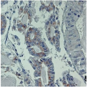 chaperoneopathy