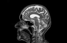 Chefarzt für Radiologie / Neuroradiologie (m/w/d)