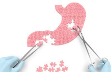Chefarzt f&uuml;r Gastroenterologie (m/w/d)